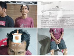 Dikeroyok Security, Kepling dan Acil, Korban Lapor Ke Polda Sumut Minta Pelaku Segera Ditangkap