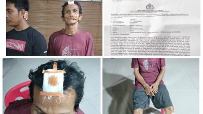 Dikeroyok Security, Kepling dan Acil, Korban Lapor Ke Polda Sumut Minta Pelaku Segera Ditangkap