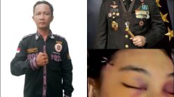 DPW Media Center LSM PAKAR Sumut Desak Kapolri Turun Tangan, Deretan Kejanggalan Kematian Ibu Bhayangkari Winda Lorenza Gowasa Dinilai Harus Dibuka Terang – Benderang