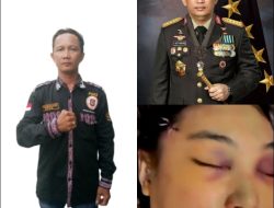 DPW Media Center LSM PAKAR Sumut Desak Kapolri Turun Tangan, Deretan Kejanggalan Kematian Ibu Bhayangkari Winda Lorenza Gowasa Dinilai Harus Dibuka Terang – Benderang